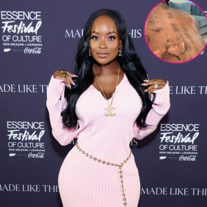 RHOA s Shamea Morton Sues Over Chemical Burn Gone Wrong